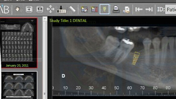 Low-price implants gaining interest