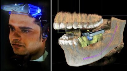 CFAO et facteurs de croissance — Domaines clés de l’innovation en odontologie