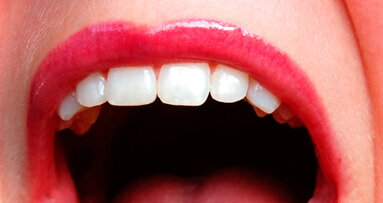 Ottobre, mese della prevenzione con visite gratuite dai dentisti ANDI, test del pH salivare e prestazioni a tariffe calmierate