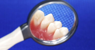 Harde woorden PvdA-kamerlid over vrije tarieven