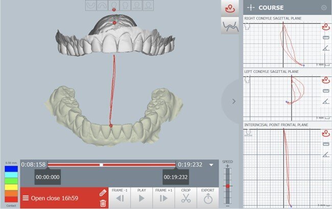 Fig. 8_Tracciato di apertura.