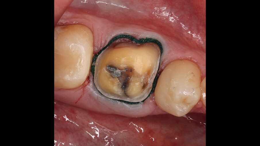 Fig. 2 - Esempio di acquisizione di scansioni a colori.