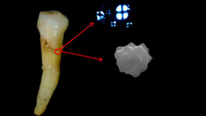 Isola di Pasqua: una placca dentale fa scoprire l’utilizzo di una pianta fondamentale nella dieta preistorica