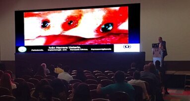 La alergia al titanio en implantología