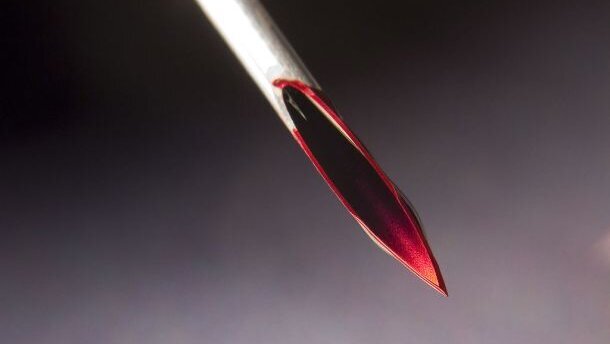 Onveranderd veel prikaccidenten in mondzorg