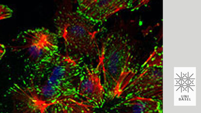 Transkriptionsfaktor zur Metastasenbildung entdeckt Transkriptionsfaktor zur Metastasenbildung entdeckt