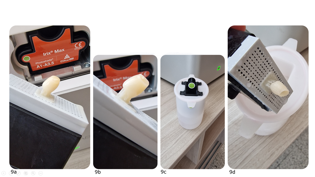Figs. 9a–d: In just 15 minutes, the Irix Max crown is printed (a). Before removing the crown from the printing plate and detaching the supports (b), the operator rinses the restoration in ethanol for a few minutes using a dedicated tool (c). After removing the liquid resin, the operator detaches the restoration (d) and places it in the polymerisation unit.