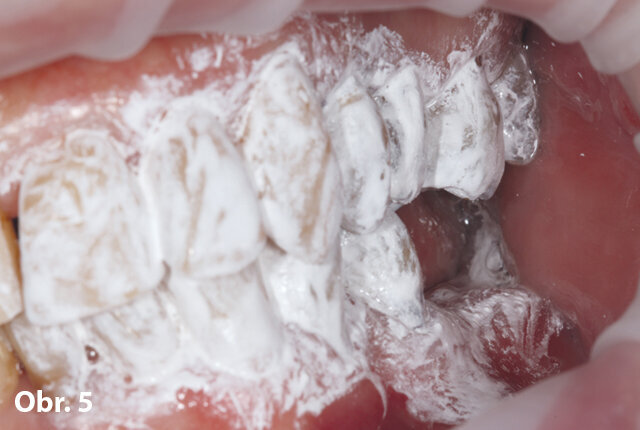 pracovní postup preoperačního skenování