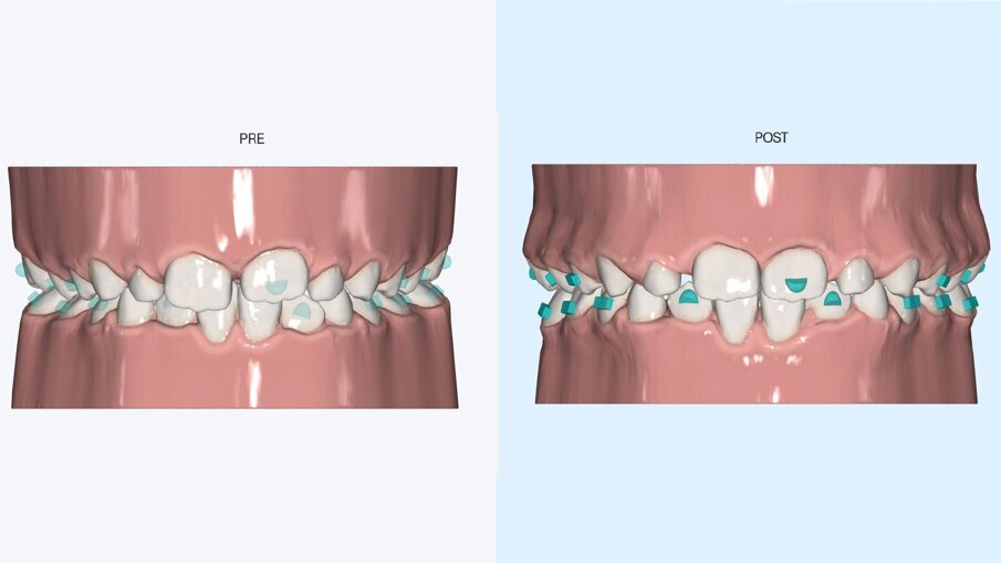 Fig. 3_Primo set up digitale.