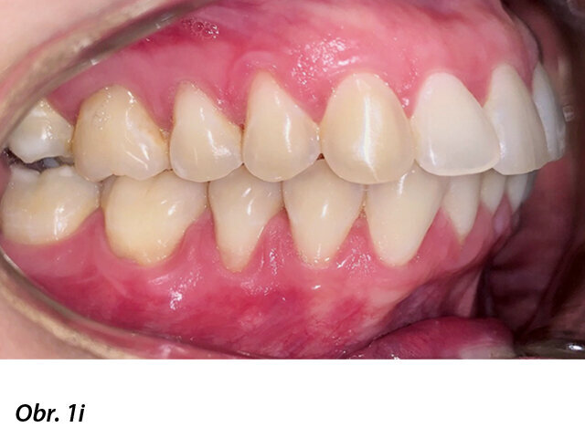 Pacientka 1 – Počáteční fotografie.