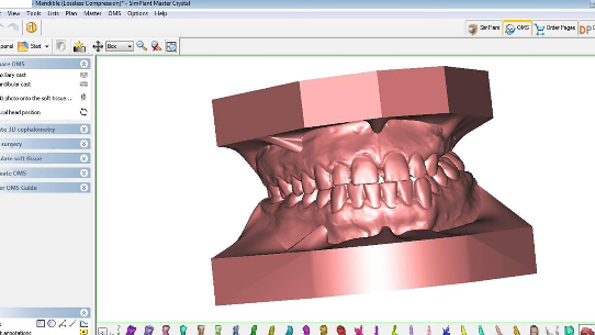 TC Cone Beam e scanner in ortognatodonzia: dalla diagnosi al manufatto