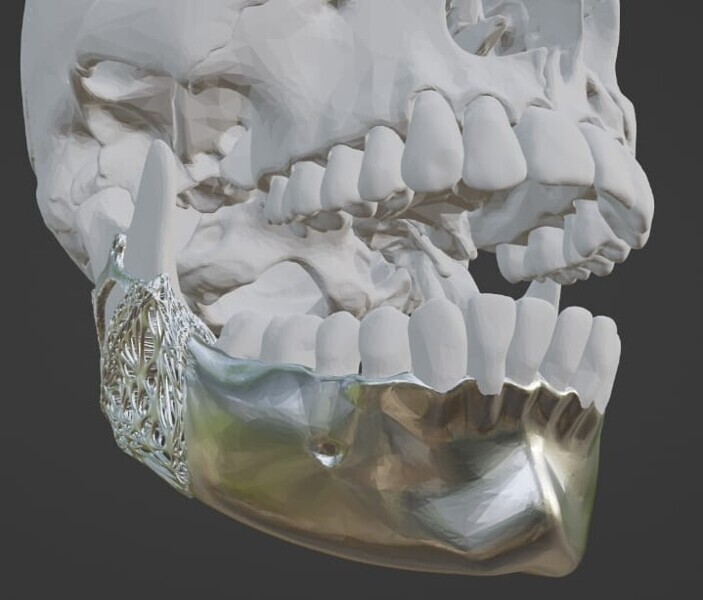 Fig 1a. Fig. 1a–i: The use of CAD software is crucial to designing a scaffold for biomaterials that will result in a bone nearly identical to that which was lost or damaged. (All images were created with the open software Blender [licensed as GNU GPL, version 3.6 LTS] by Forrest Hall) 