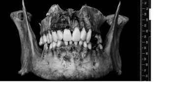 Mô hình 3D kỹ thuật số mới cho giáo dục nha khoa pháp y