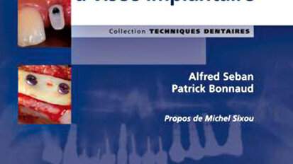 Nouveauté : Le bilan préopératoire à visée implantaire