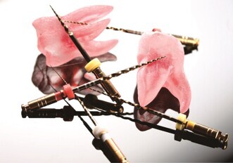 Shenzhen Perfect Medical Instruments – MG3 rotary files