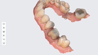 3D printing in dentistry: The secret to offering more for less