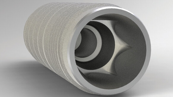 Champions Implants: An ideal solution for the general dentist