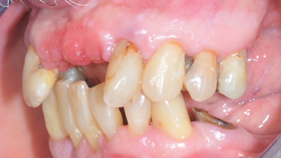 Fig. 1b_Situazione clinica iniziale.