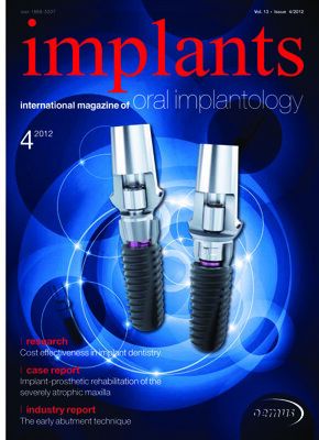 implants international No. 4, 2012 implants international No. 4, 2012