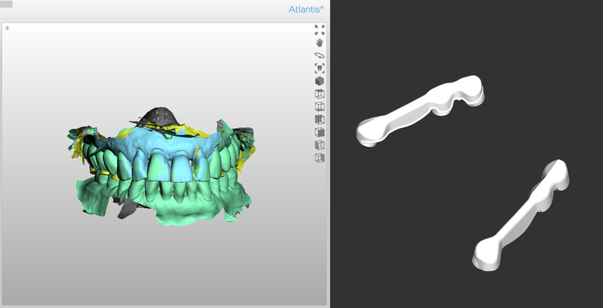 Fig. 12: Atlantis Scan Upload with Atlantis BridgeBase core files.