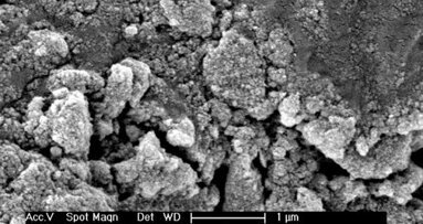 L’effet photoacoustique en endodontie