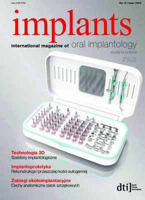 implants Poland No. 1, 2018 implants Poland No. 1, 2018