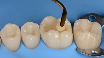 Free webinar highlights advantages of biomimetic approach to dentistry Free webinar highlights advantages of biomimetic approach to dentistry