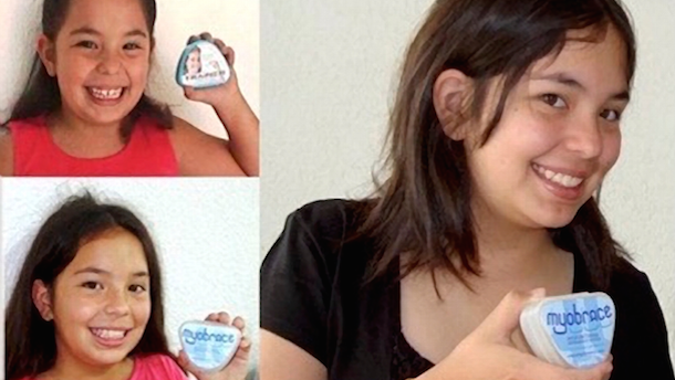 Evolución del tratamiento miofuncional postural con los sistemas de MRC (1)