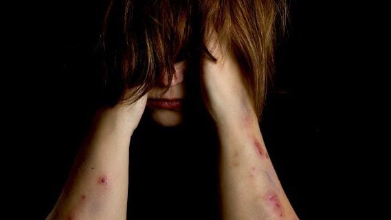 Opfer häuslicher Gewalt erhalten neues Lächeln