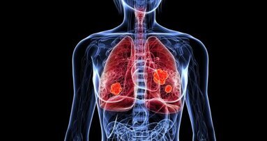 Krebsdiagnose durch Atemtest