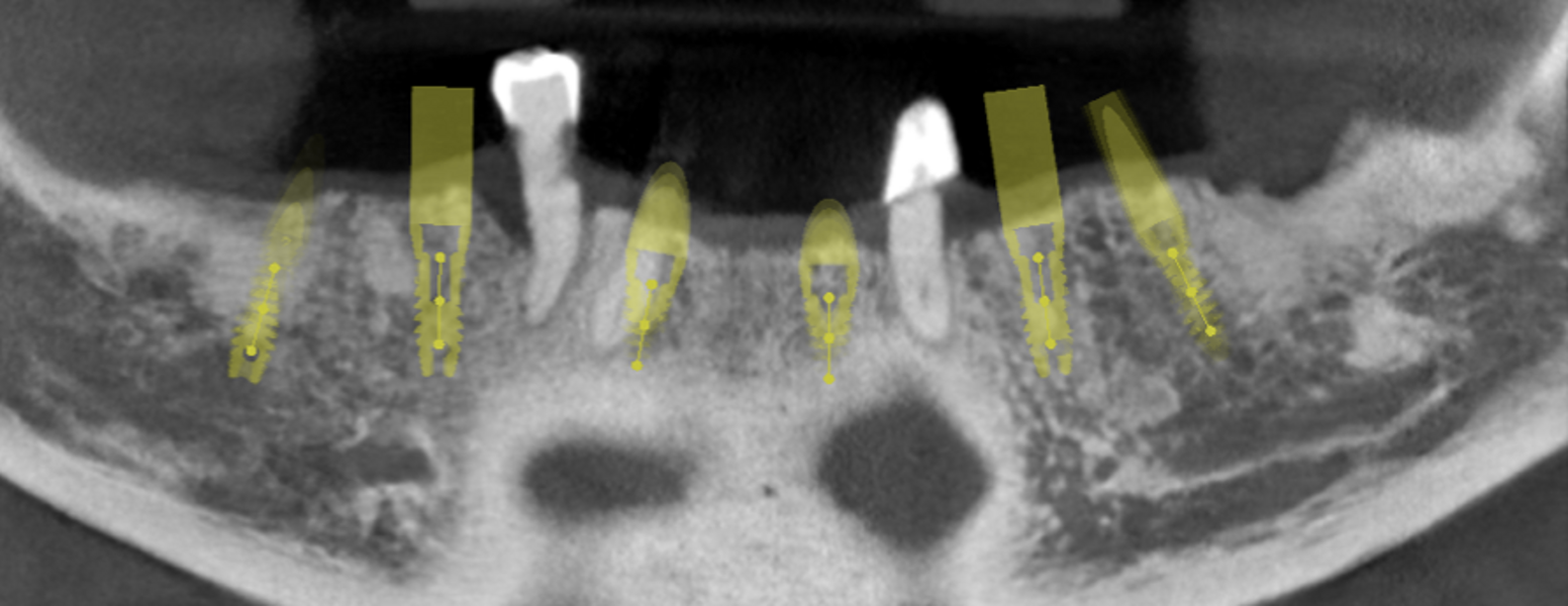 Fig. 4 : Planification.