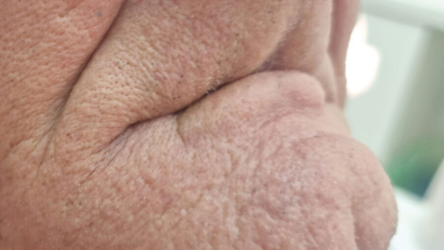 Fig. 13 - Senza provvisori - vista laterale.