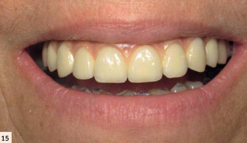 Sourire de notre patiente.