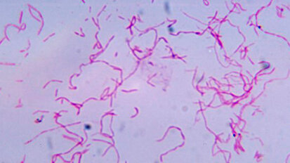 Un patogeno orale protegge le cellule tumorali contro le cellule immunitarie