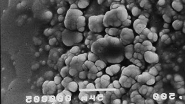 ADF 2014 : conférences «Une bouche en toute sécurité »