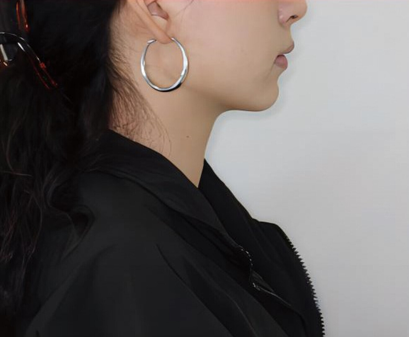 Fig. 4b: Facial profile.