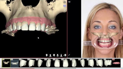 ¿Qué convierte a un Ortodoncista en Experto? (Parte II)
