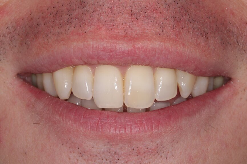 Fig. 15: Post-treatment smile