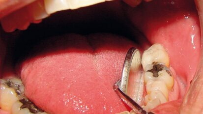 “La medicina e l’odontoiatria biologica fra tradizione ed innovazione: uso dei metalli pesanti, aspetti clinici e legali”