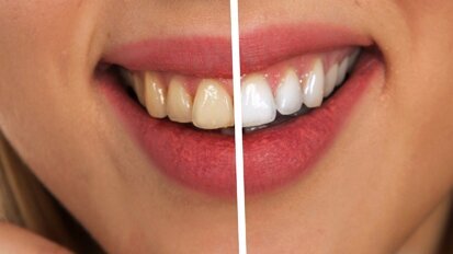 PTS nawiązało współpracę z European Society of Cosmetic Dentistry