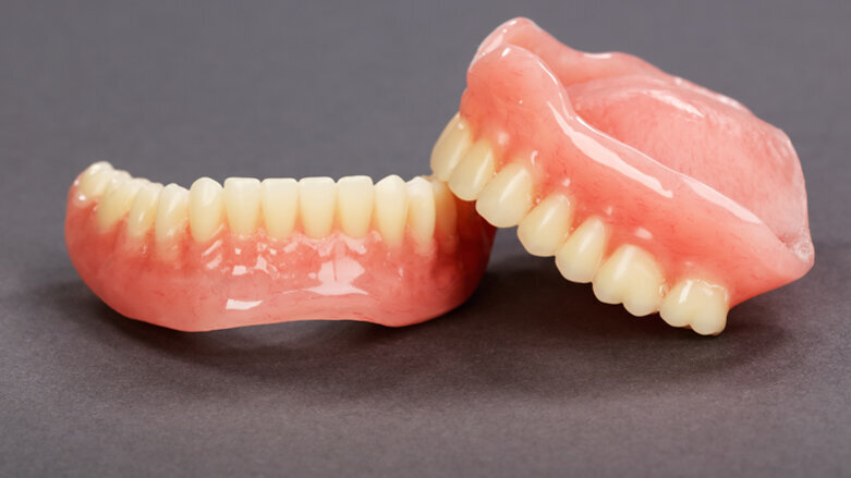 Festzuschüsse für Zahnersatz sollen um 10 Prozent steigen