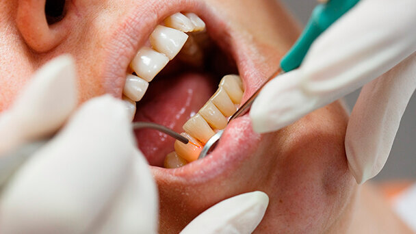 L’Europa del laser si ritrova a Parma per i premi del Progetto EMDOLA