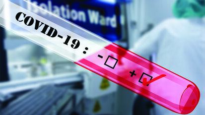 Gönüllü Diş Hekimleri Salgına Karşı Sahada