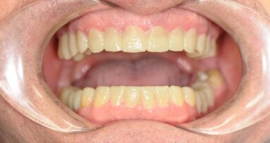 Interdyscyplinarne planowanie leczenia w stomatologii estetycznej