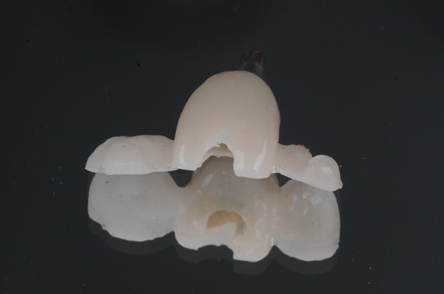 Fig. 24_Accesso a vite passante.