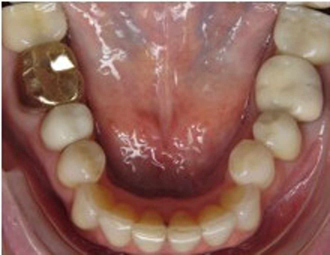 Fig. 9d: After. 