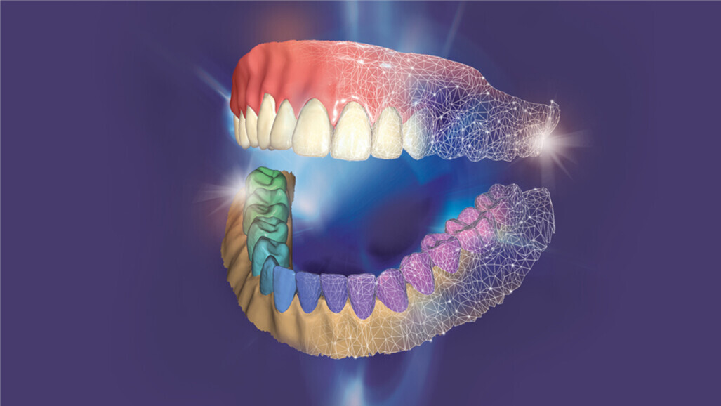 exocad – DentalCAD