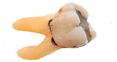 Couple finds human tooth in sausage