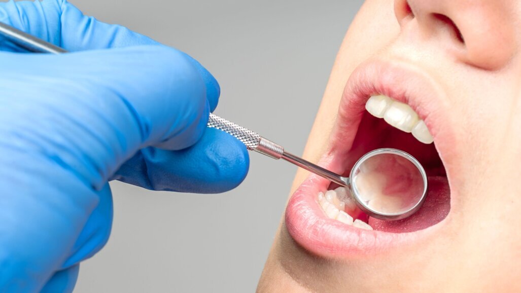 唾液检测可以对牙周病产生革命性的影响