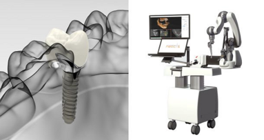 Un sistema robótico que podría cambiar la implantología